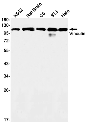 Vinculin