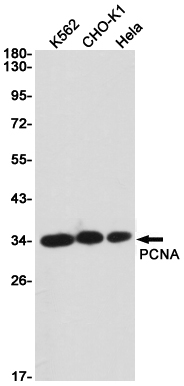 PCNA