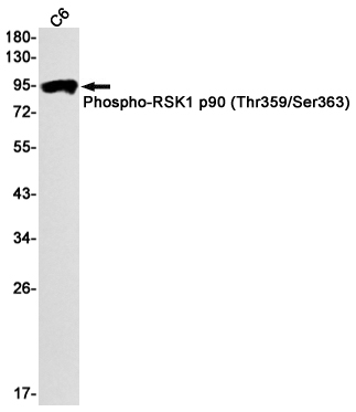 Phospho~RSK1 p90 (Thr359/Ser363)