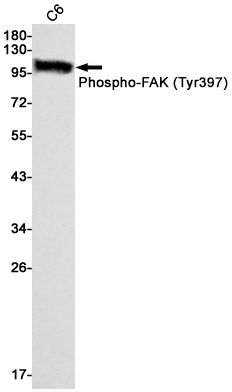 Phospho~FAK (Tyr397)