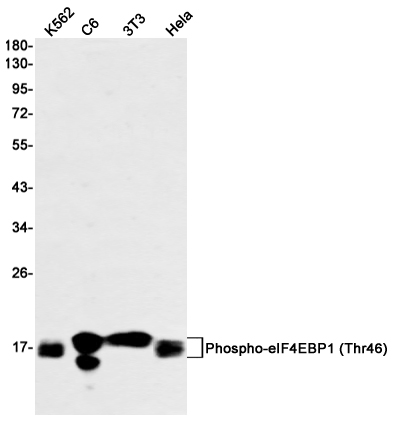 Phospho~eIF4EBP1/eIF4EBP2/eIF4EBP3 (Thr45)