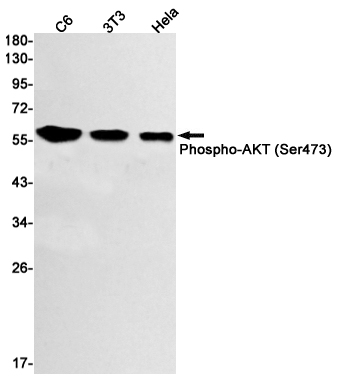 Phospho~AKT1 (Ser473)