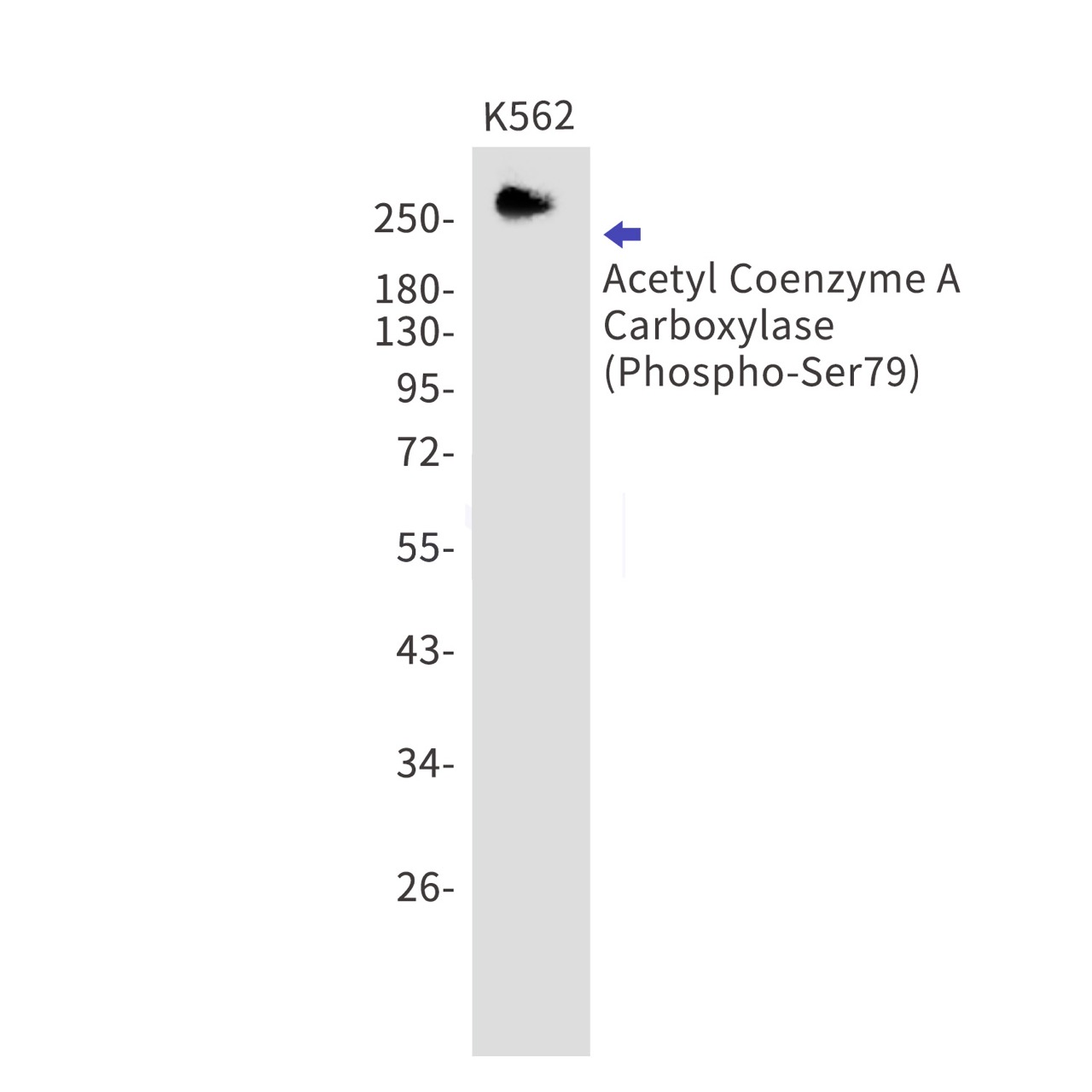Phospho~Acetyl Coenzyme A Carboxylase (Ser79)