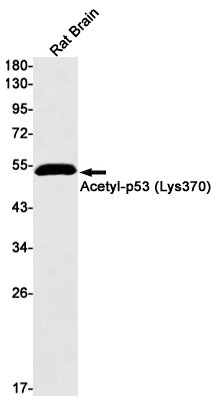 Acetyl~p53 (Lys370)