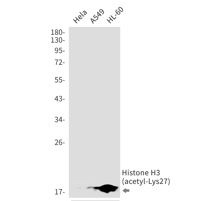 Acetyl~Histone H3 (Lys27)