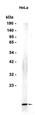 TriMethyl~Histone H3 (Lys4)