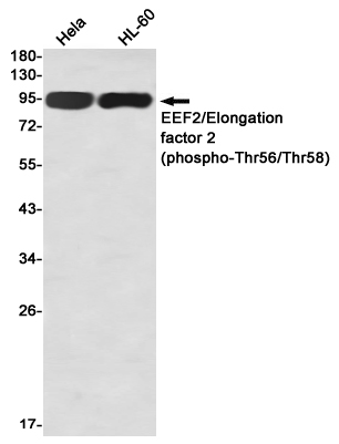 Phospho~EEF2 (Thr56/Thr58)