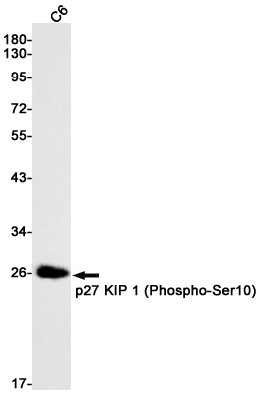 Phospho~p27 KIP 1 (Ser10)