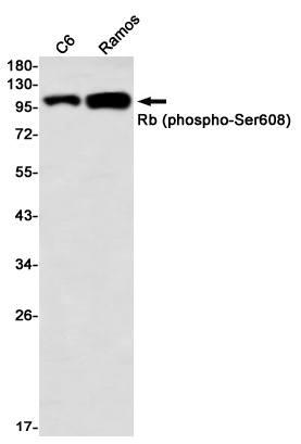 Phospho~Rb (Ser608)