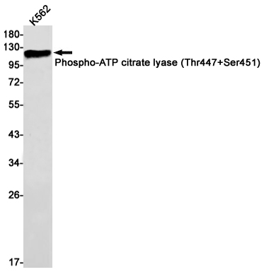 Phospho~ATP citrate lyase (Thr447/Ser451)