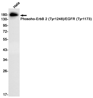Phospho~ErbB 2 (Tyr1248)/ErbB 4 (Tyr1284)
