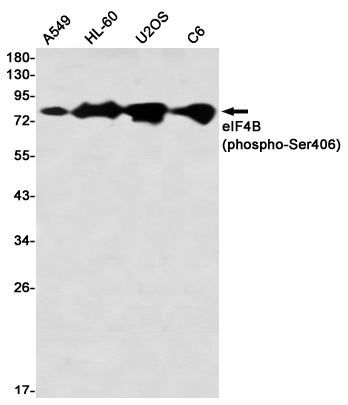 Phospho~eIF4B (Ser406)