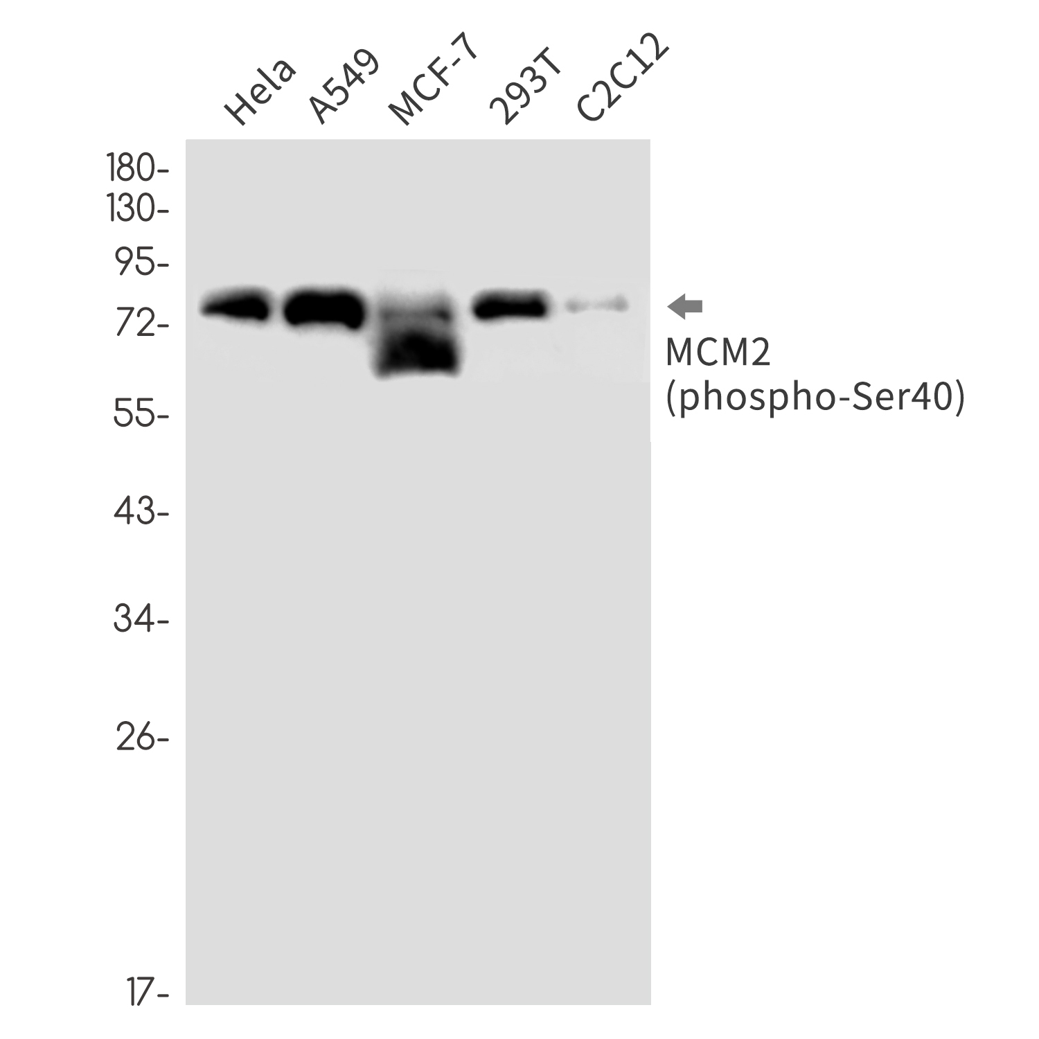 Phospho~MCM2 (Ser40)