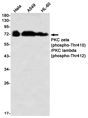 Phospho~PKC zeta/lambda (Thr410/Thr412)