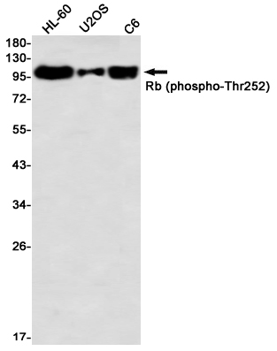 Phospho~Rb (Thr252)