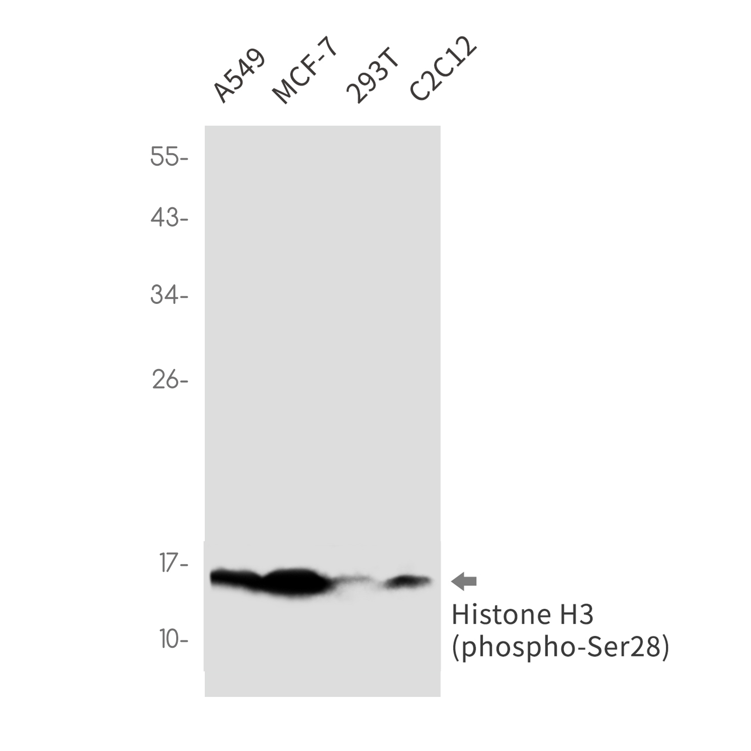 Phospho~Histone H3 (Ser28)