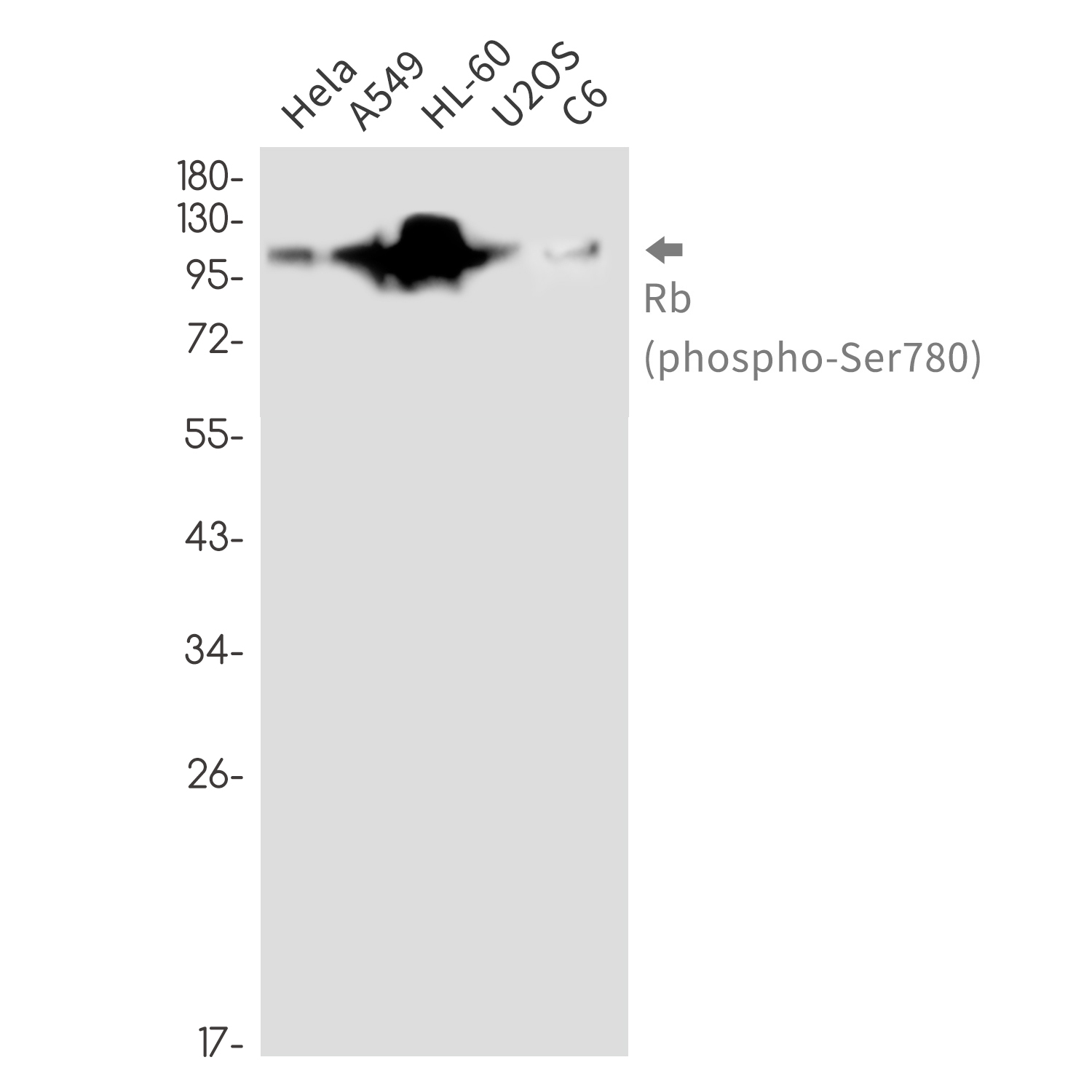 Phospho~Rb (Ser780)