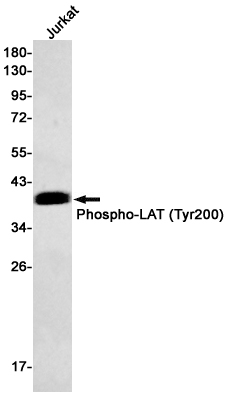 Phospho~LAT (Tyr200)