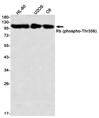 Phospho~Rb (Thr356)