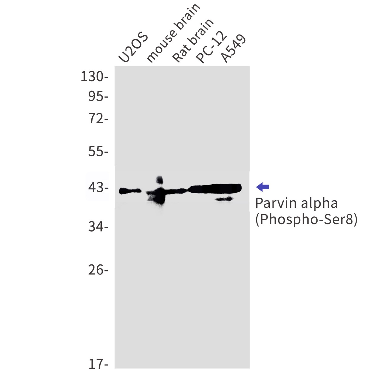 Phospho~Parvin alpha (Ser8)