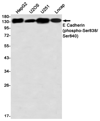 Phospho~E Cadherin (Ser838/Ser840)