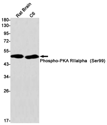 Phospho~PKA RII alpha (Ser99)