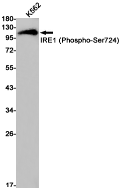 Phospho~IRE1 (Ser724)