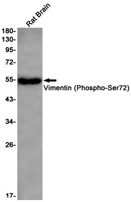 Phospho~Vimentin (Ser72)