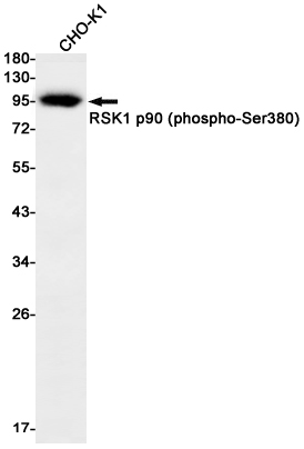 Phospho~RSK1 p90 (Ser380)