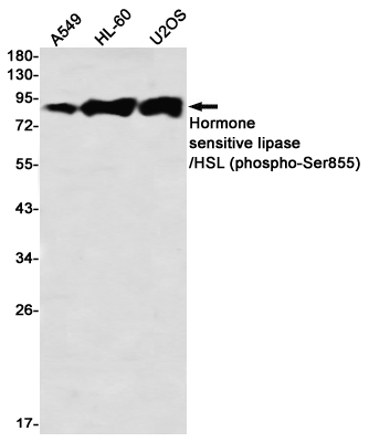 Phospho~Hormone Sensitive Lipase (Ser855)