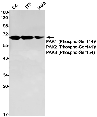 Phospho~PAK1/2/3 (Ser144/Ser141/Ser154)