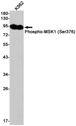 Phospho~MSK1 (Ser376)