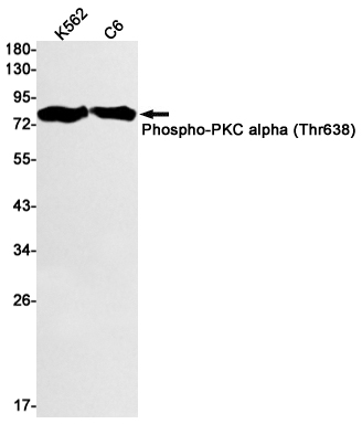 Phospho~PKC alpha (Thr638)