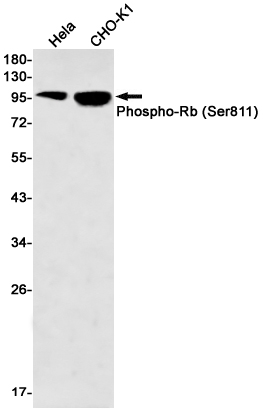 Phospho~Rb (Ser811)