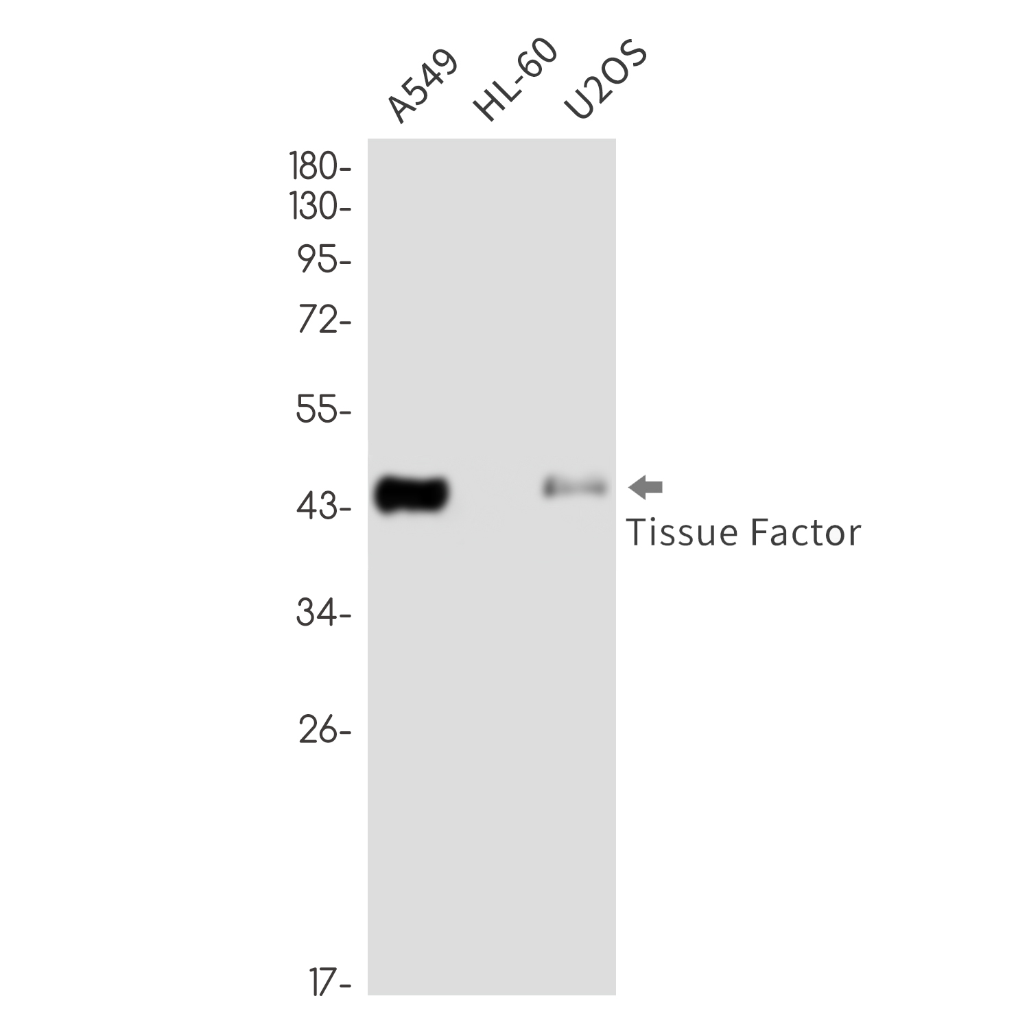 Tissue Factor