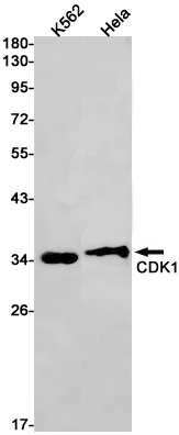 CDK1