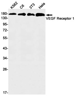 VEGF Receptor 1