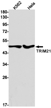 TRIM21