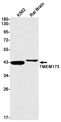 Transmembrane Protein 173
