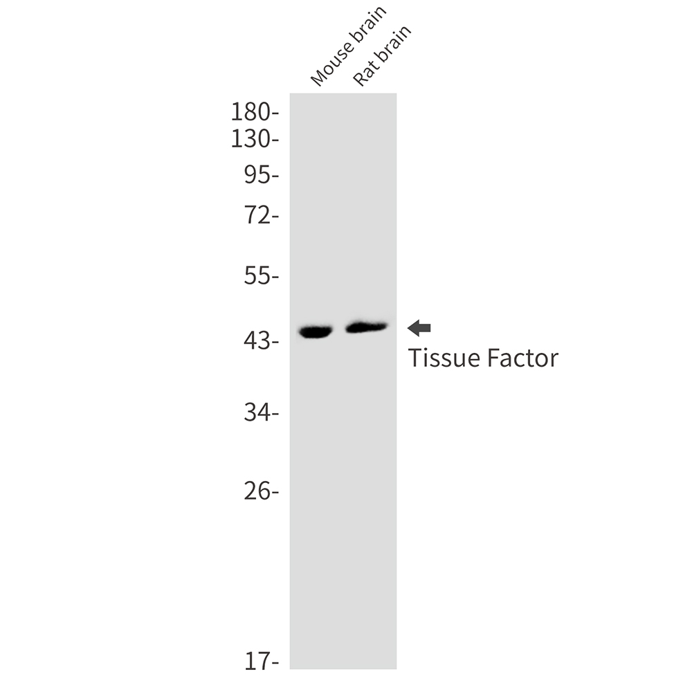Tissue Factor