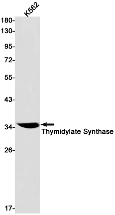 Thymidylate Synthase