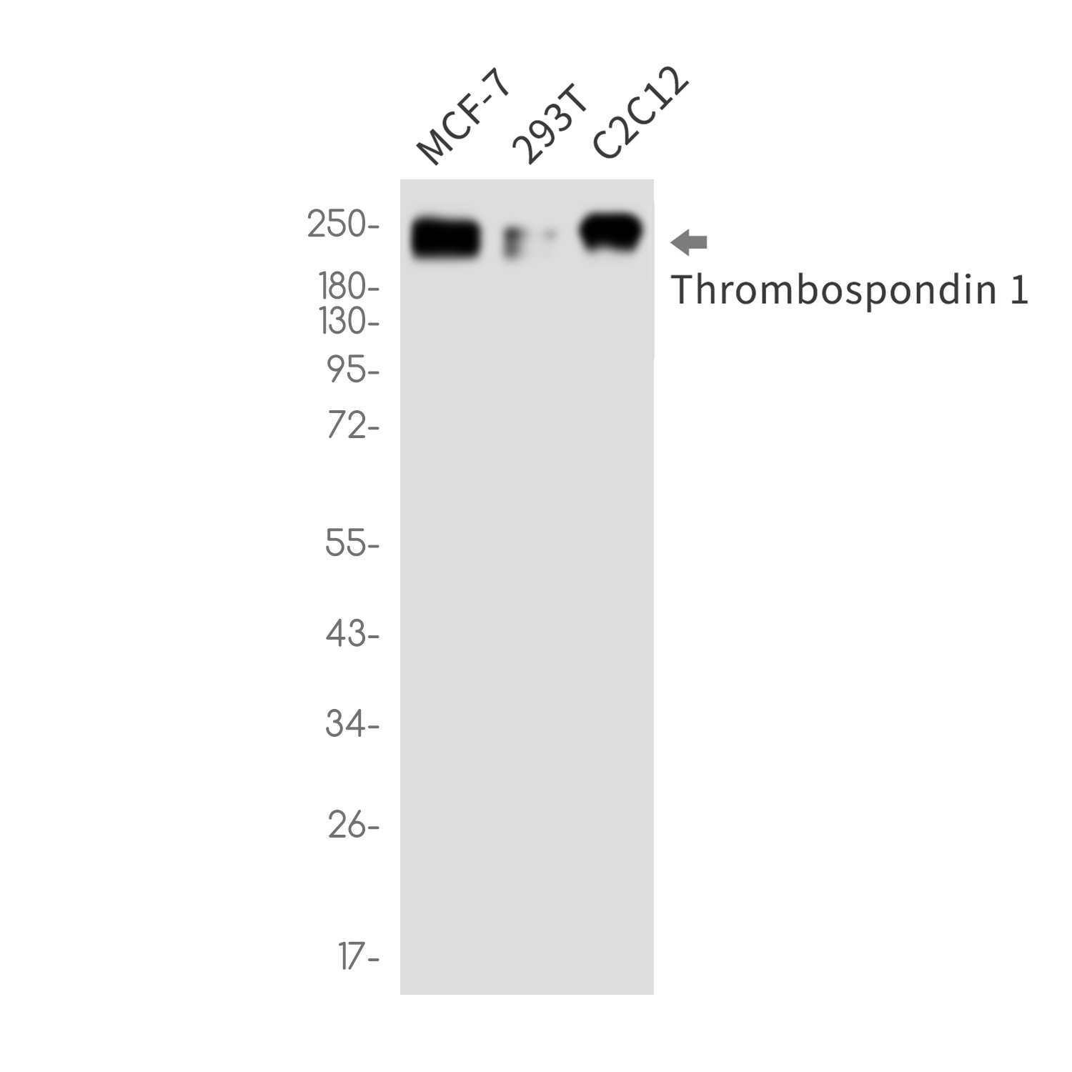Thrombospondin 1