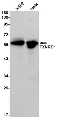 Thioredoxin Reductase 1