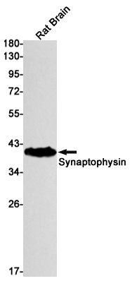Synaptophysin