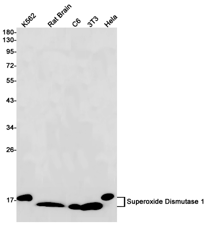Superoxide Dismutase 1