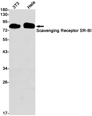 Scavenging Receptor SR~BI