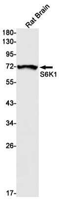 S6K1