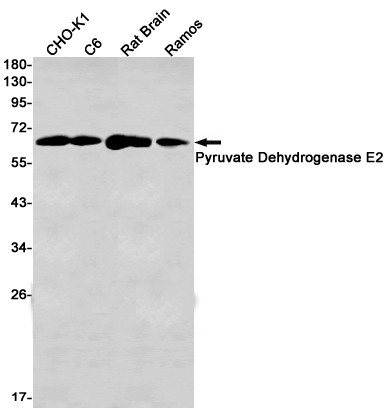 Pyruvate Dehydrogenase E2