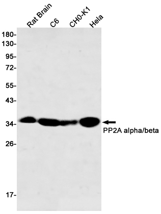 PP2A alpha/beta