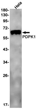 PDPK1